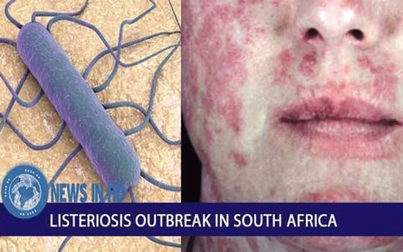 2018 Listeriosis Outbreak in South Africa.