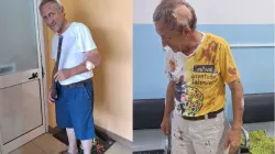 Fr. Luigi de Liberale was seriously injured during an attempted robbery at a Salesian community in Angola’s Benguela Diocese. Credit: Fr. Luigi de Liberale