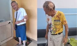 Fr. Luigi de Liberale was seriously injured during an attempted robbery at a Salesian community in Angola’s Benguela Diocese. Credit: Fr. Luigi de Liberale