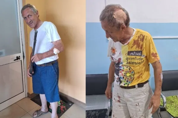 Fr. Luigi de Liberale was seriously injured during an attempted robbery at a Salesian community in Angola’s Benguela Diocese. Credit: Fr. Luigi de Liberale